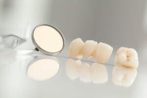 Dental bridge next to a mirror on a reflective whitish gray surface